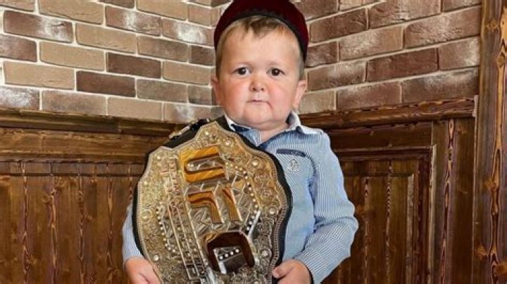 Hasbulla Magomedov Maladie