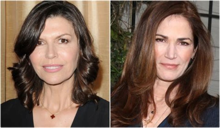 Kim Delaney Plastic Surgery Before and After